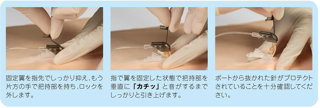 医療機器製品: セーフタッチコアレスニードル®セット