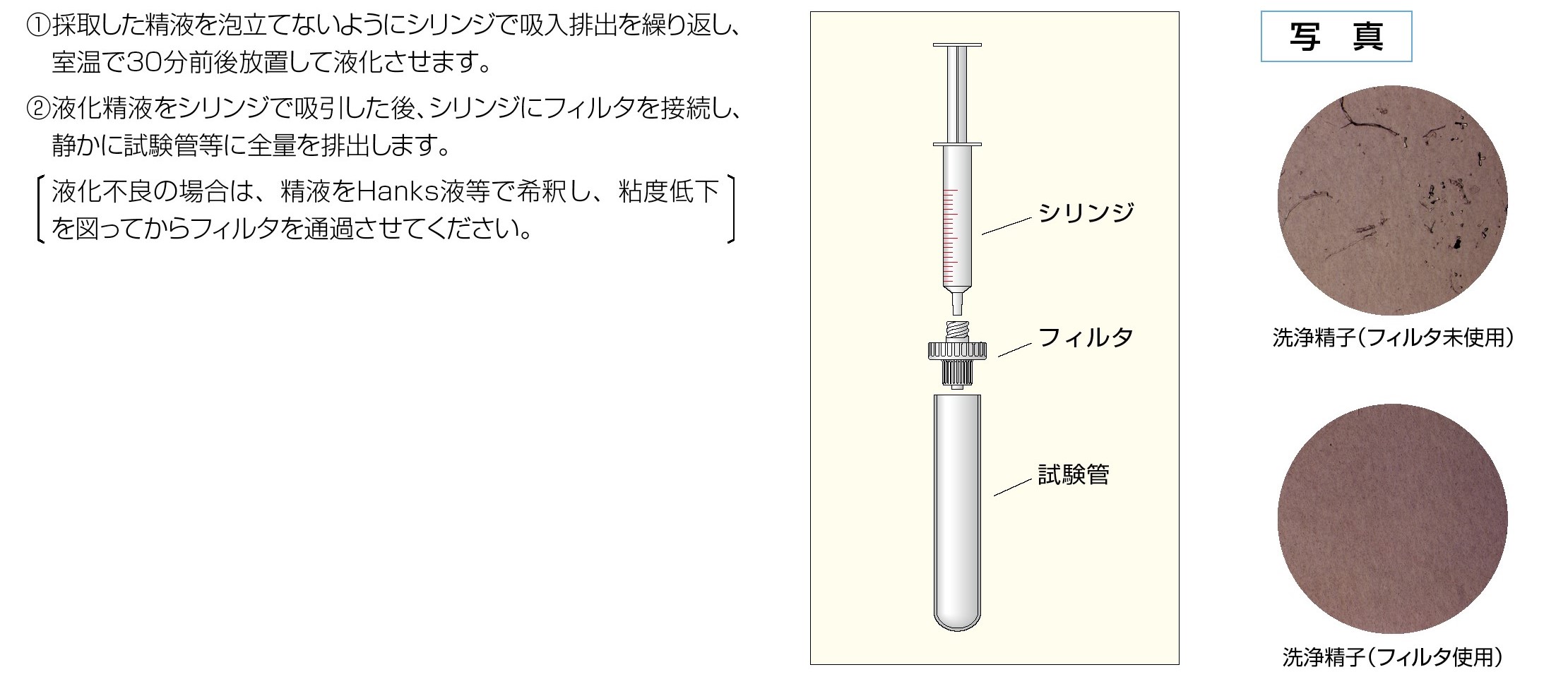 医療機器製品: 精子調製器具